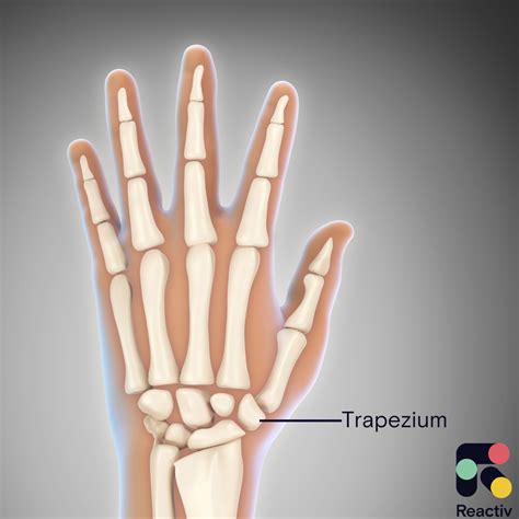 trapeziectomy.